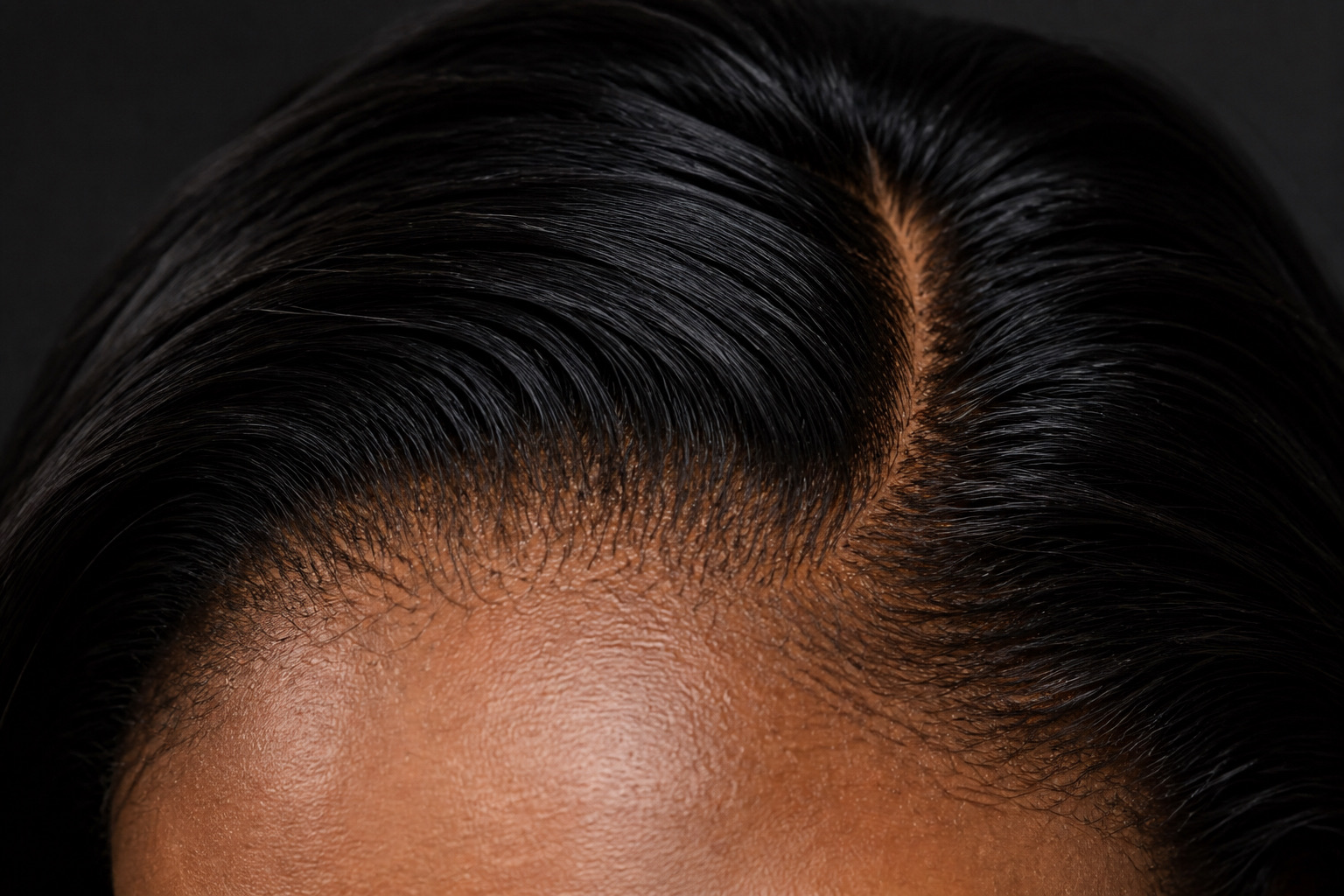 Hairline after applying LAYD