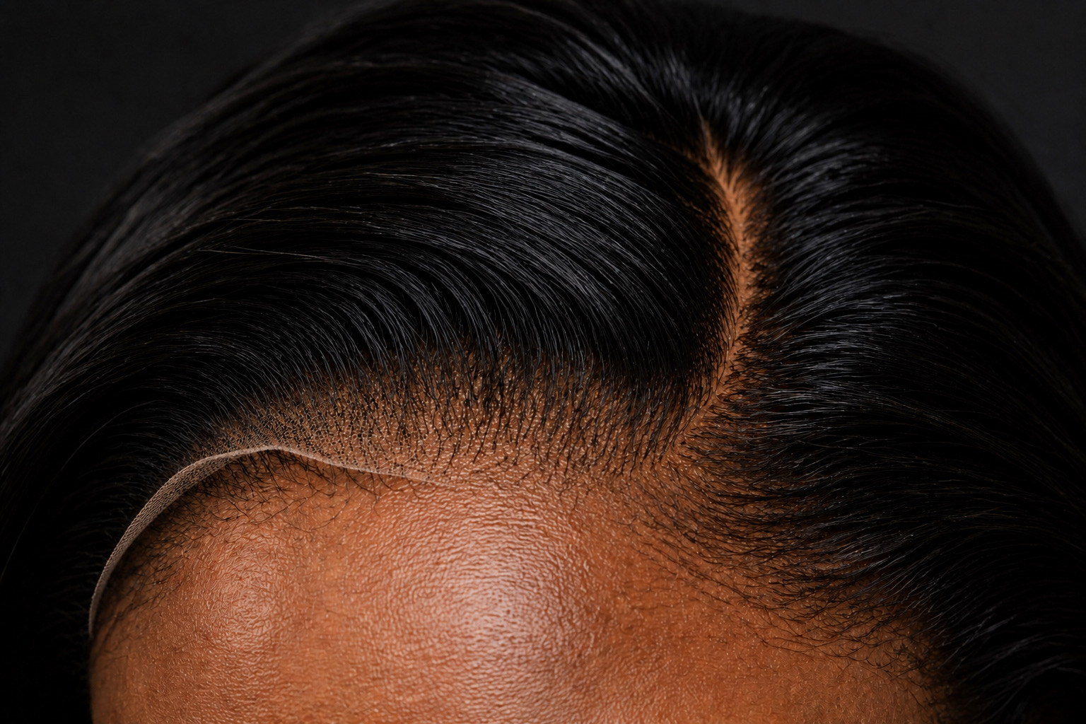 Hairline before applying LAYD